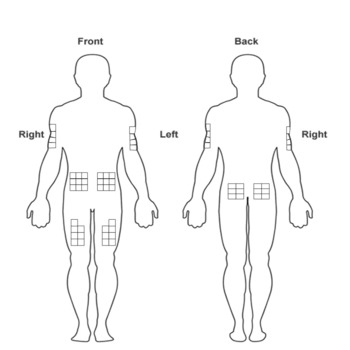 Diabetes Injection Site Rotation