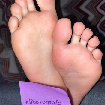 ALE