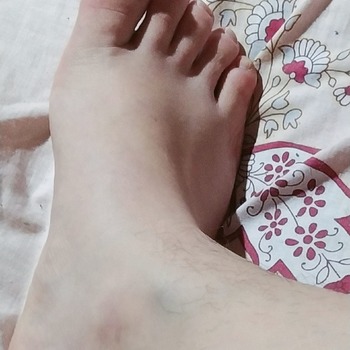 Pies